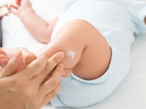 小児皮膚疾患について